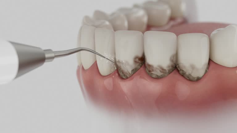 Trusted Tooth Extraction service in Sylacauga, AL - Dentist Open Now
